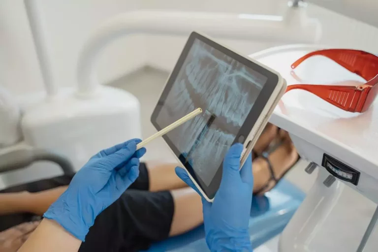 Techniki leczenia ortodontycznego i rola aparatów ortodontycznych